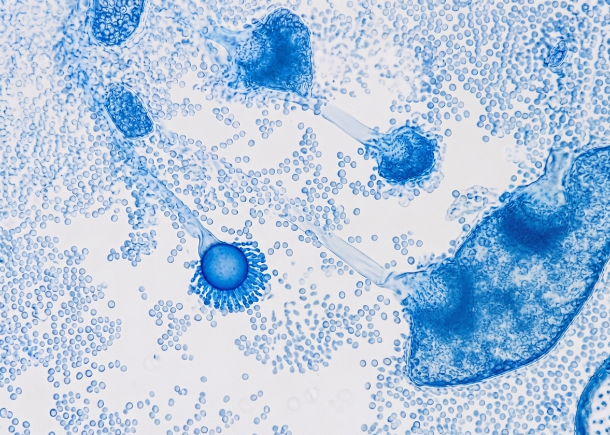 Wastewater and antifungal resistance: a new challenge for global health