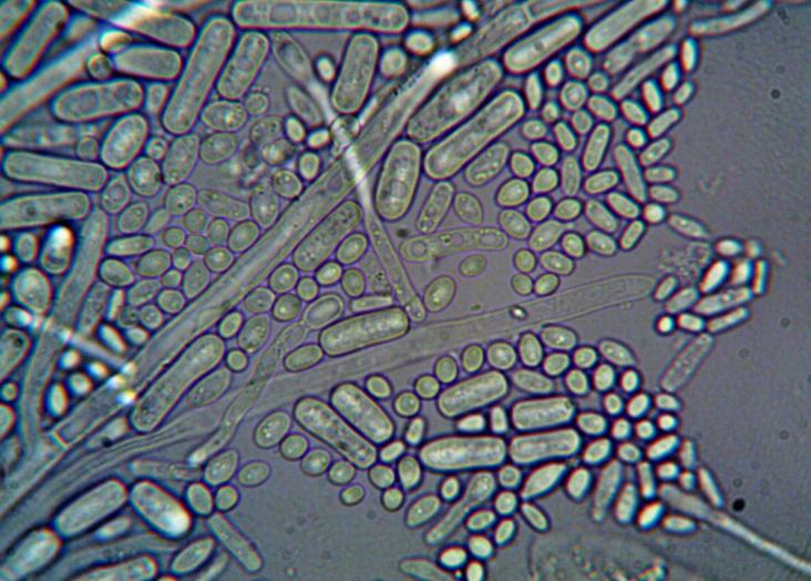 Microbial Ecology for Nature-Based Innovation