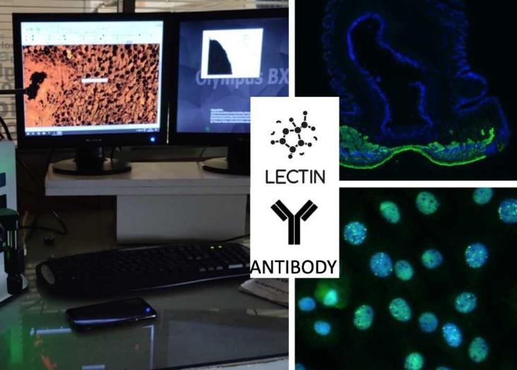 Hands-on training on protein and glycan detection by fluorescence microscopy 2022-2023