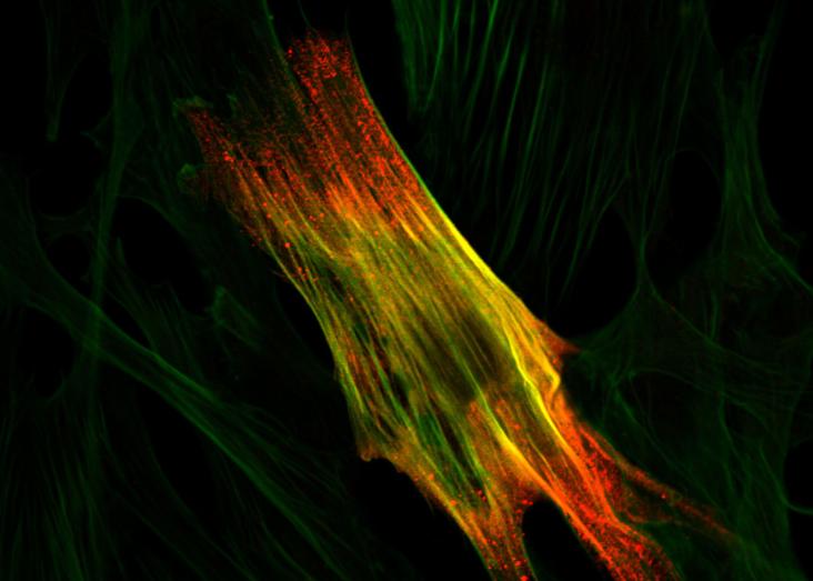 From Mice to Patients: Uncovering the Role of LAMA2 in Skeletal Muscle Development and Disease From Mice to Patients: Uncovering the Role of LAMA2 in Skeletal Muscle Development and Disease