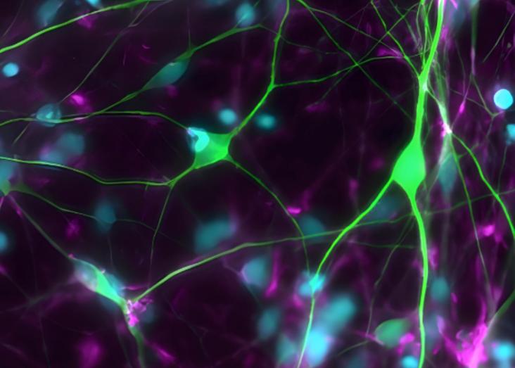 Peripheral-tissue stress signaling promotes developmental stability via brain neuron oscillation in Drosophila