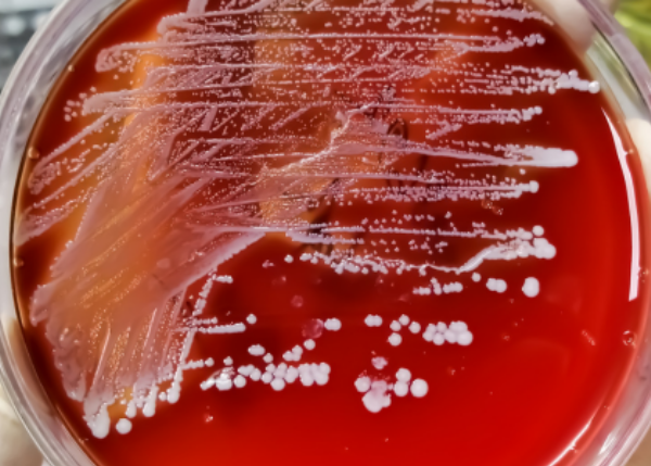RNA Structural Dynamics in Bacterial Pathogens and Their Role in Environmental Adaptation