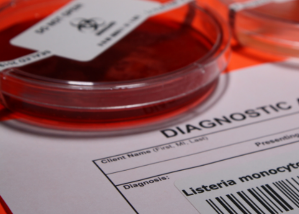 Why Won’t It Leave? Genomic Clues to Listeria monocytogenes Persistence in Food Environments